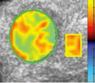 Vuebox Liver Tissue Analysis