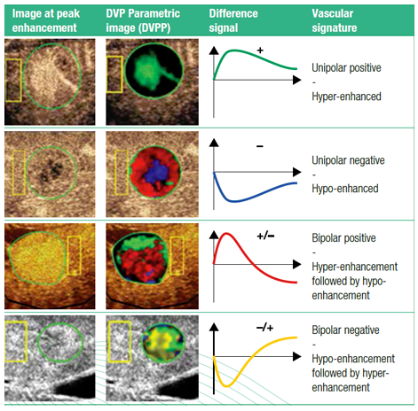 VueBox Dynamic Vascular Pattern Parametric